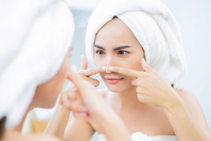 4 Products to Use to Prevent Acne